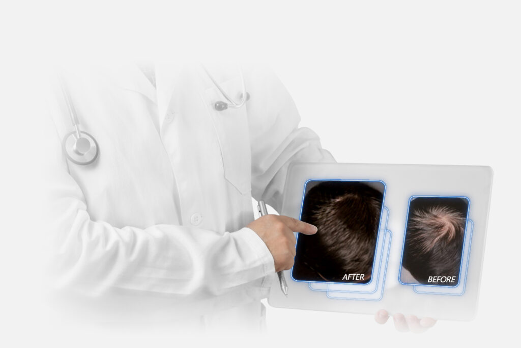 HairBeam Air หมวกเลเซอร์ปลูกผม