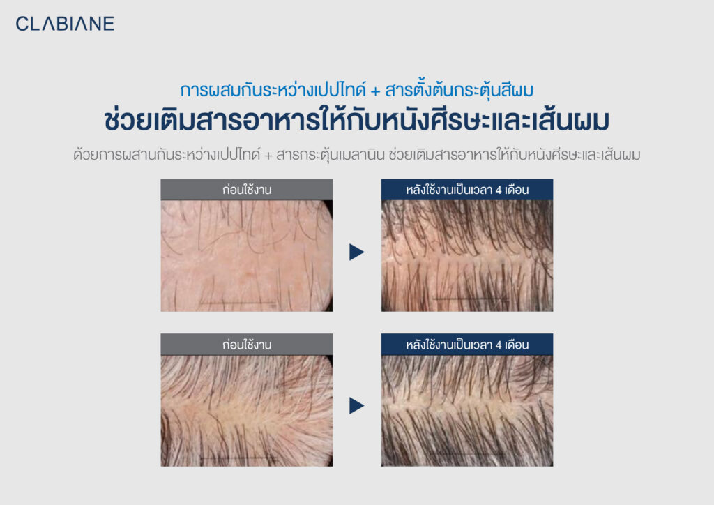 Hair Beam Scalp Ampoule
